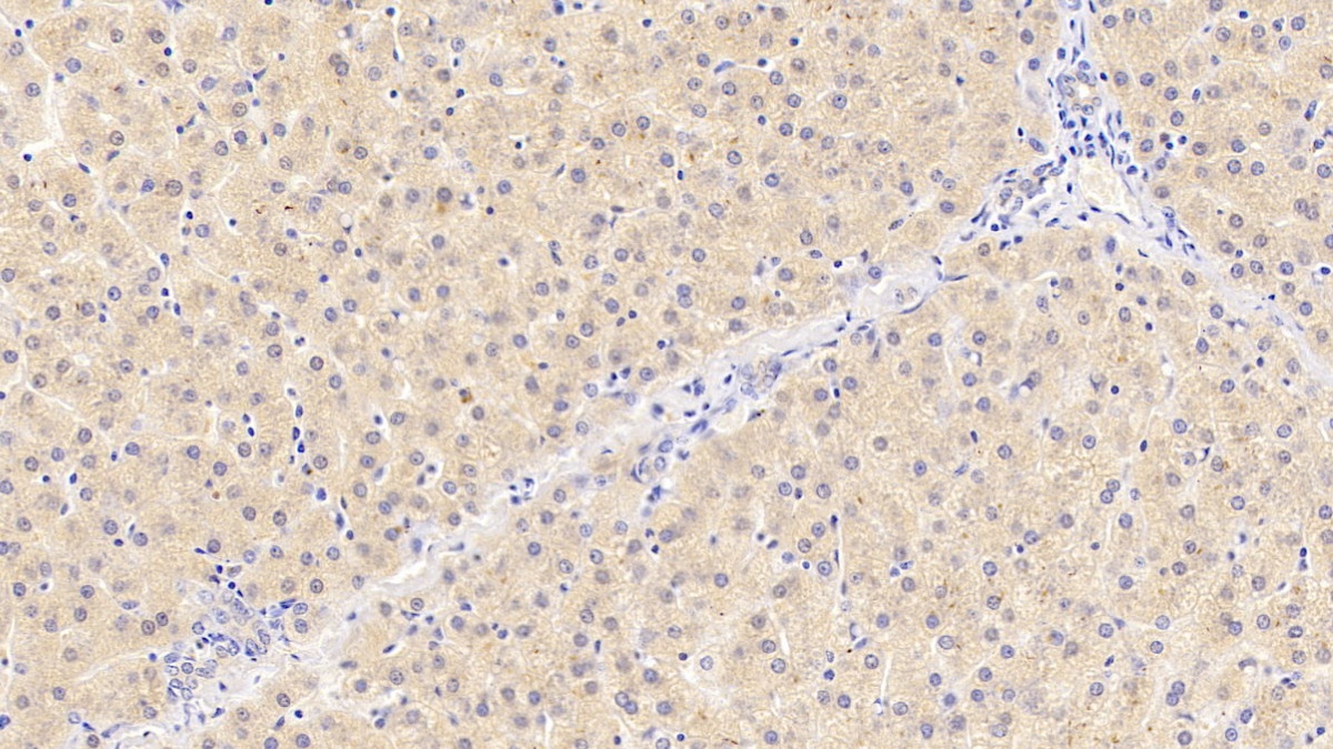 Polyclonal Antibody to Protein C (PROC)