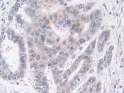 Polyclonal Antibody to Prostaglandin I Synthase (PTGIS)