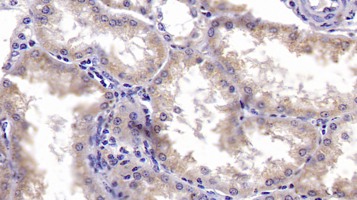 Polyclonal Antibody to Metallothionein 3 (MT3)