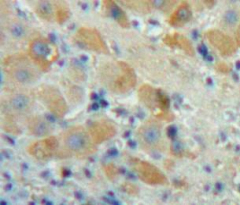 Polyclonal Antibody to Fibroblast Growth Factor 23 (FGF23)