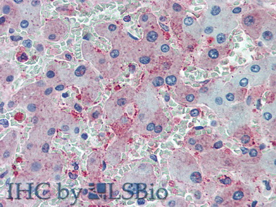 Polyclonal Antibody to Complement 1q (C1q)