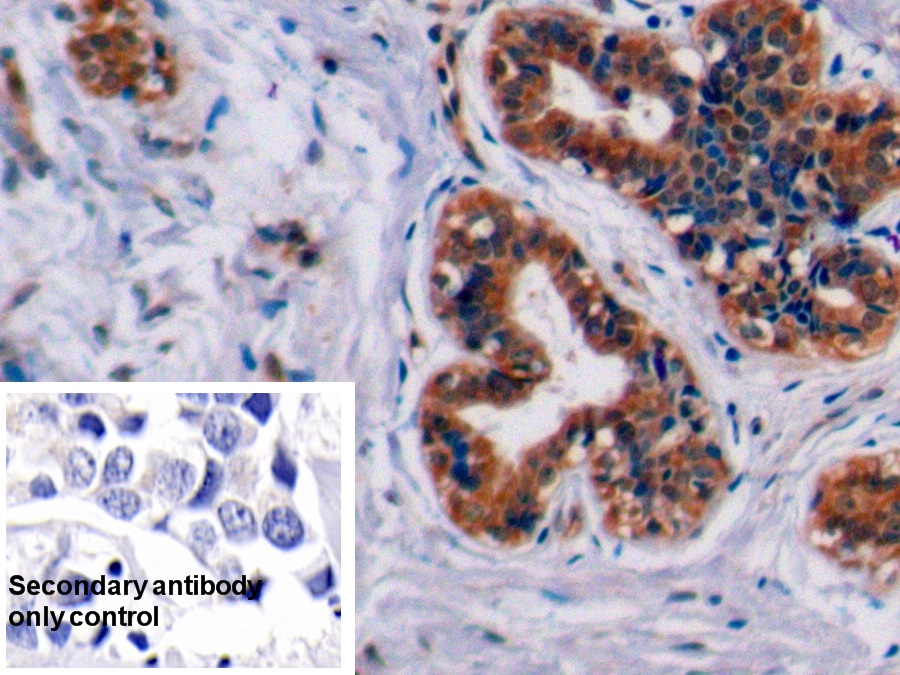 Polyclonal Antibody to Programmed Cell Death Protein 1 (PD1)