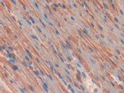 Polyclonal Antibody to Cluster Of Differentiation 38 (CD38)