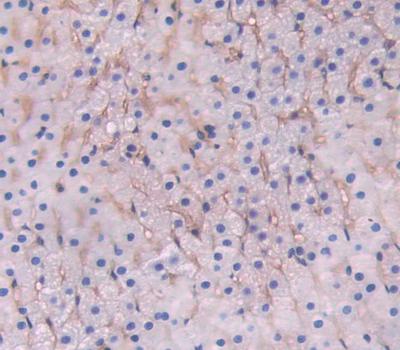 Polyclonal Antibody to Cluster Of Differentiation 38 (CD38)