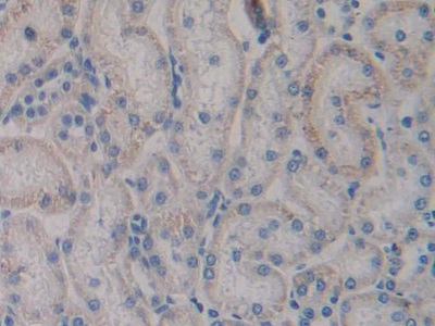 Polyclonal Antibody to Toll Like Receptor 4 (TLR4)