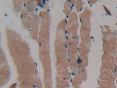 Polyclonal Antibody to Myosin Heavy Chain 2 (MYH2)