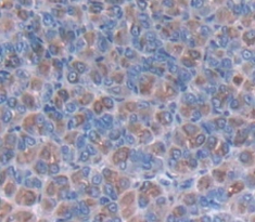 Polyclonal Antibody to Mucin 5 Subtype AC (MUC5AC)