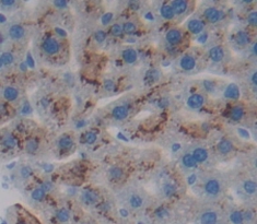 Polyclonal Antibody to Epidermal Growth Factor Receptor (EGFR)