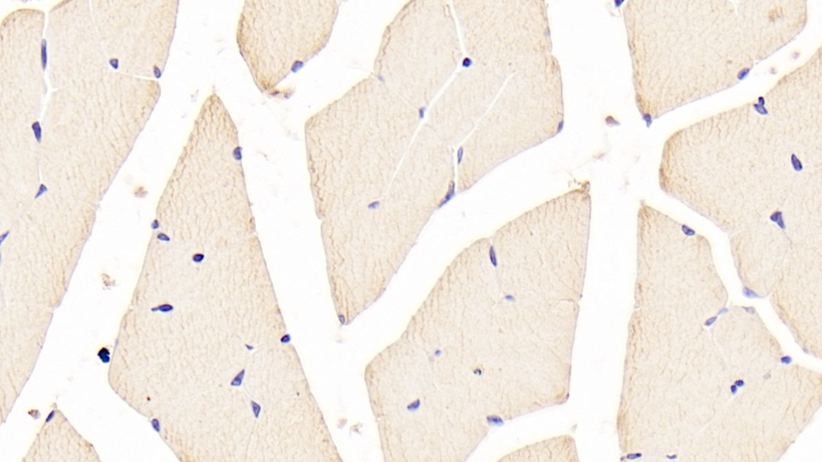 Polyclonal Antibody to Forkhead Box Protein O1 (FOXO1)