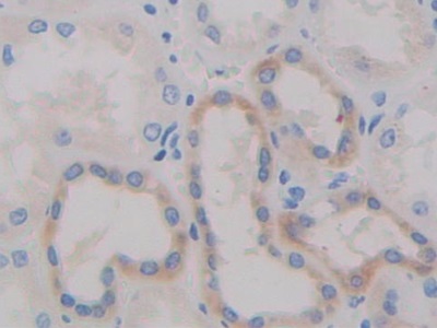 Polyclonal Antibody to A Disintegrin And Metalloprotease 10 (ADAM10)