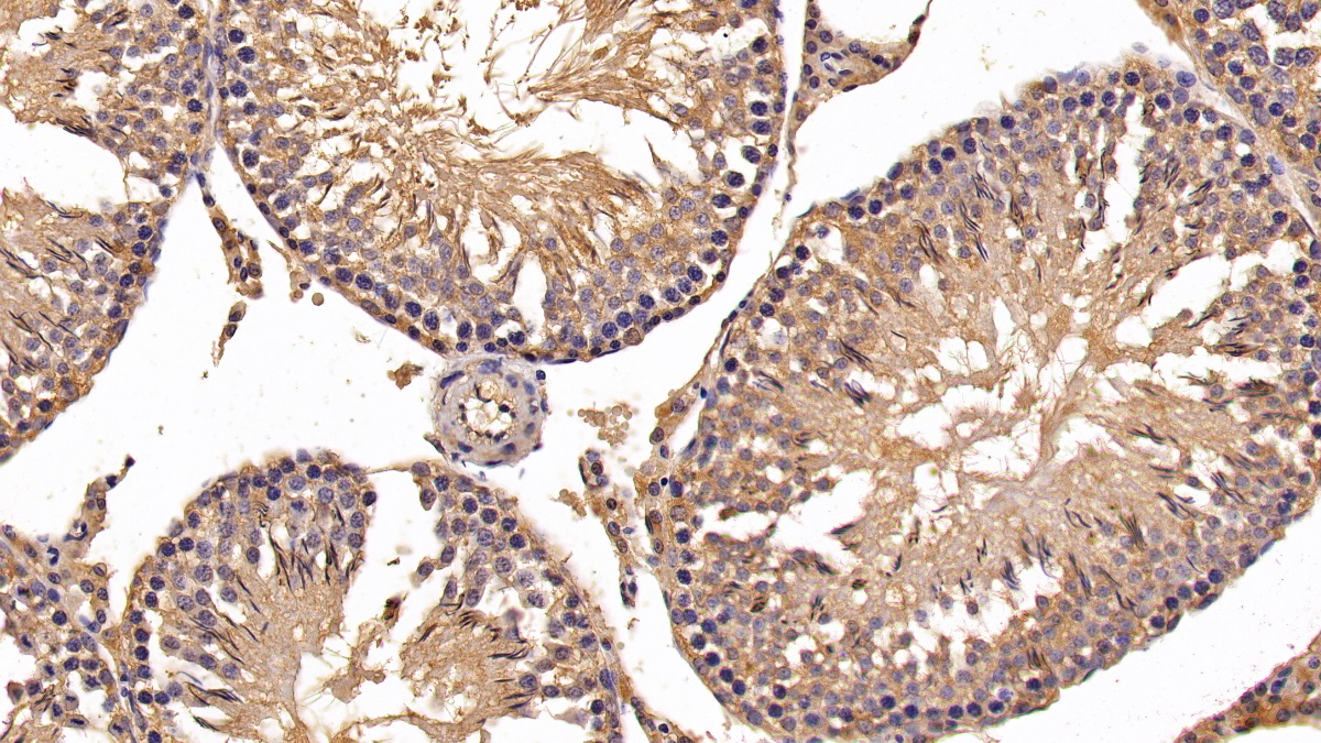 Polyclonal Antibody to Hexokinase 1 (HK1)