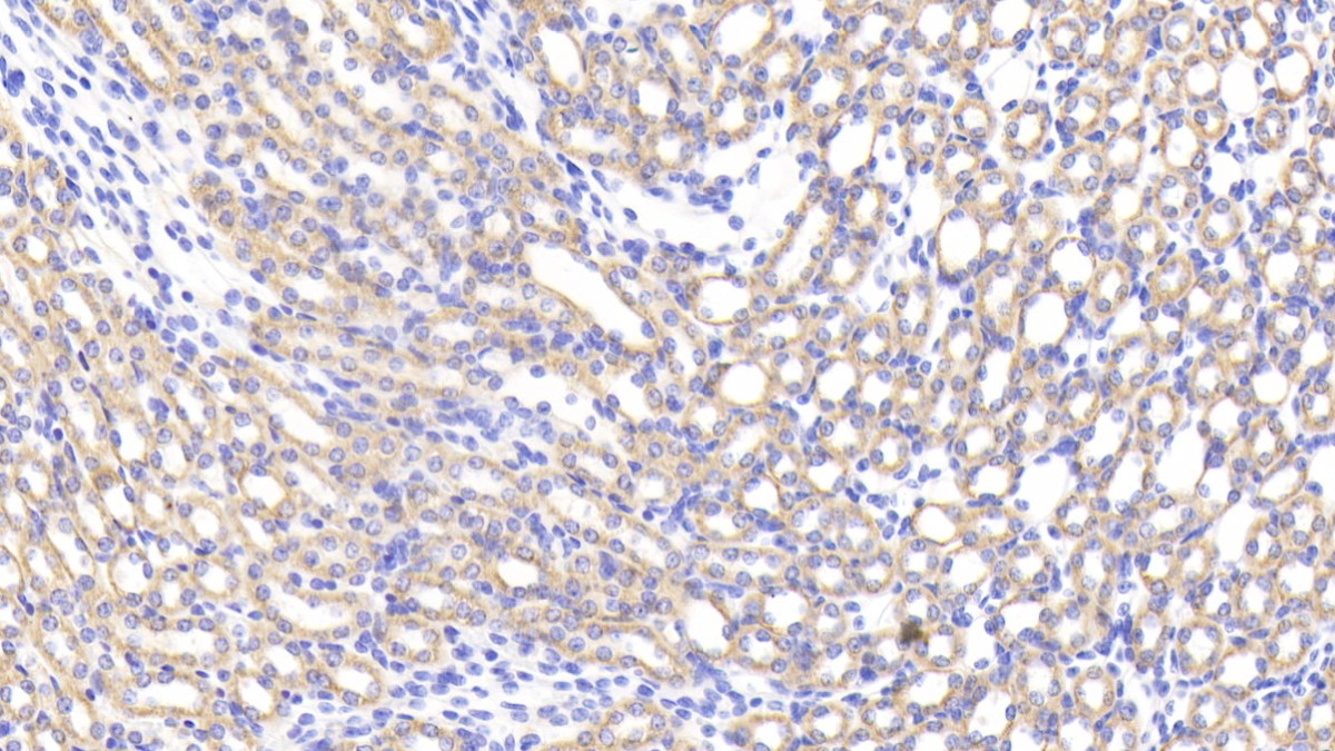 Polyclonal Antibody to Hexokinase 1 (HK1)