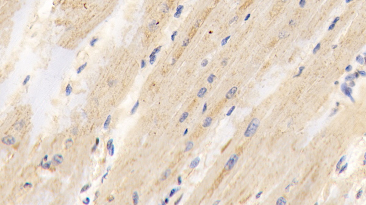 Polyclonal Antibody to Pyruvate dehydrogenase alpha 1 (PDHA1)