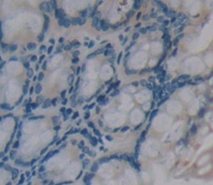 Polyclonal Antibody to Inducible T-Cell Co Stimulator (ICOS)