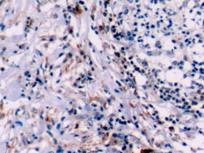 Polyclonal Antibody to B-Cell Leukemia/Lymphoma 2 (Bcl2)