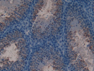 Polyclonal Antibody to Lactoferrin (LTF)