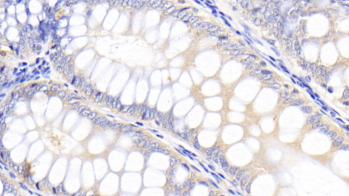 Polyclonal Antibody to Kidney Injury Molecule 1 (Kim1)