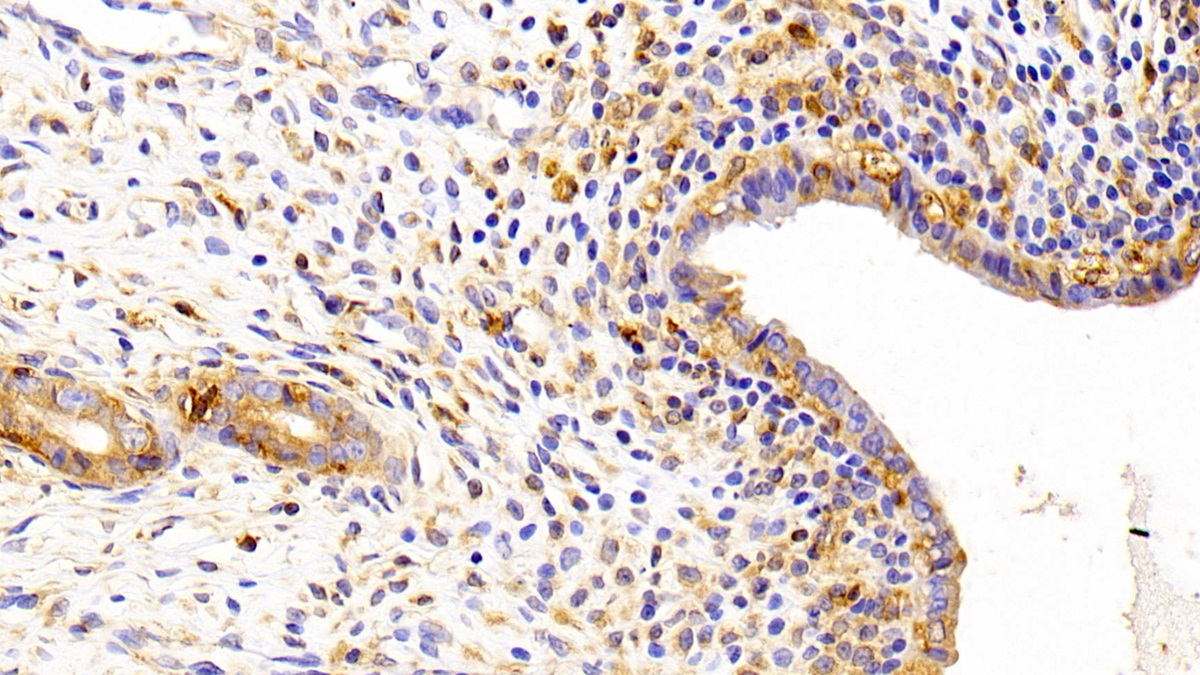 Polyclonal Antibody to Kidney Injury Molecule 1 (Kim1)