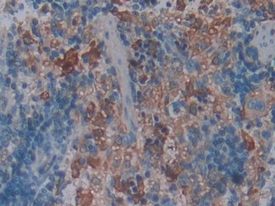 Polyclonal Antibody to Ficolin 1 (FCN1)