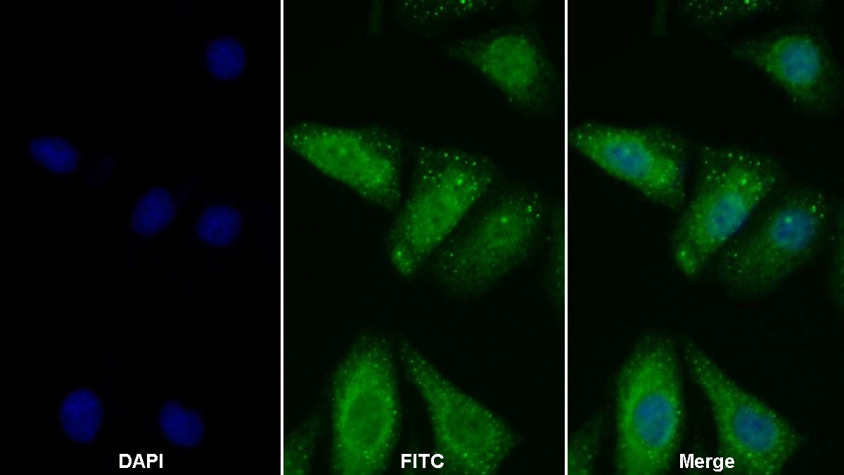 Polyclonal Antibody to Programmed Cell Death Protein 1 Ligand 1 (PDL1)