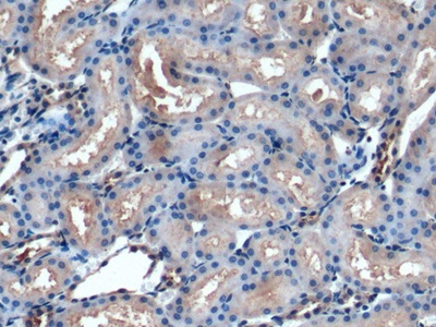 Polyclonal Antibody to Osteonectin (ON)