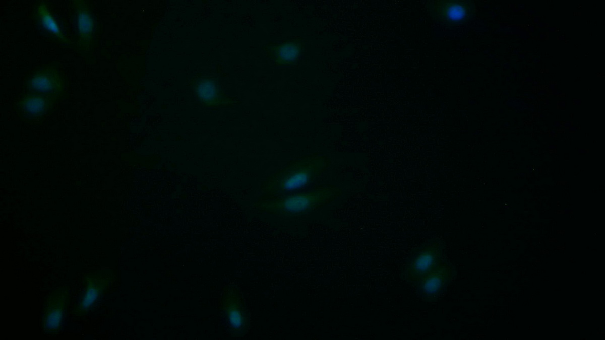 Polyclonal Antibody to Cyclin Dependent Kinase Inhibitor 2A (CDKN2A)