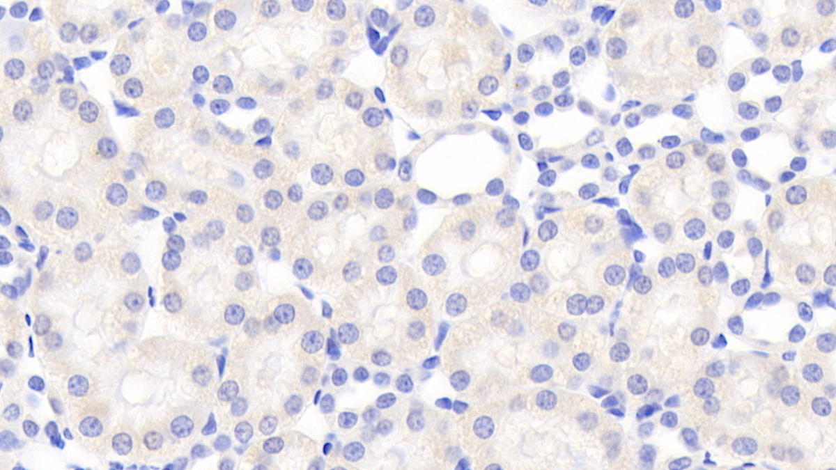 Polyclonal Antibody to Chemokine (C motif) ligand (XCL1)