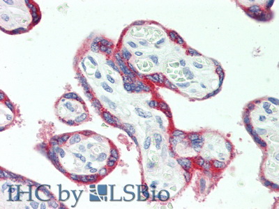 Polyclonal Antibody to Pregnancy Associated Plasma Protein A (PAPPA)