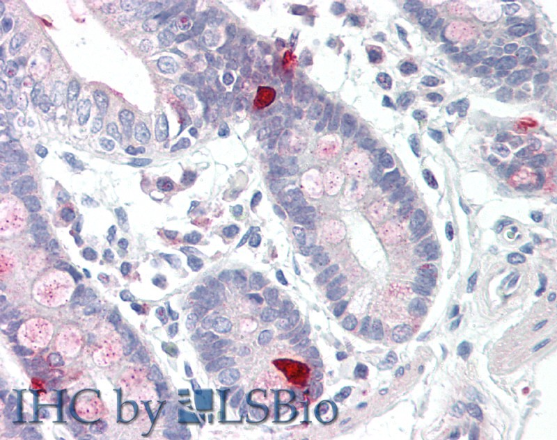 Polyclonal Antibody to Cholecystokinin (CCK)