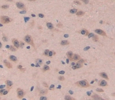 Polyclonal Antibody to Neuromedin B (NMB)