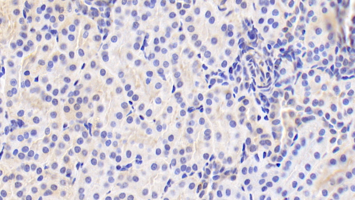 Polyclonal Antibody to Cholesteryl Ester Transfer Protein (CETP)