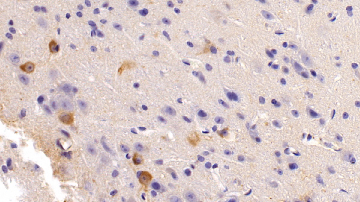 Polyclonal Antibody to Nitric Oxide Synthase 1, Neuronal (NOS1)