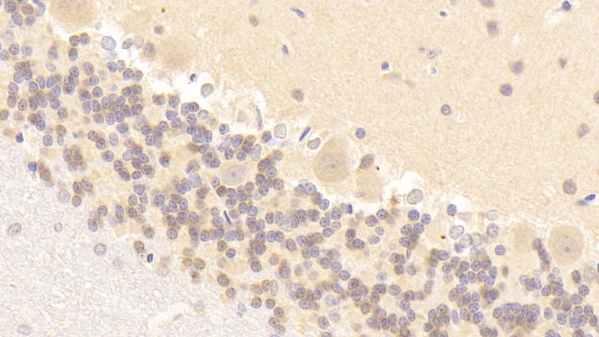 Polyclonal Antibody to Nitric Oxide Synthase 1, Neuronal (NOS1)