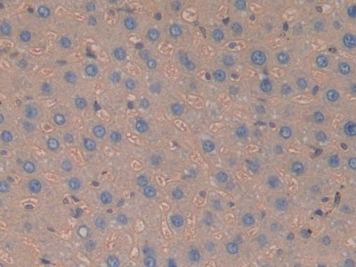 Polyclonal Antibody to Haptoglobin (Hpt)