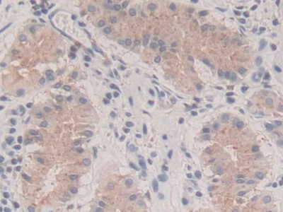 Polyclonal Antibody to Parathyroid Hormone Related Protein (PTHrP)