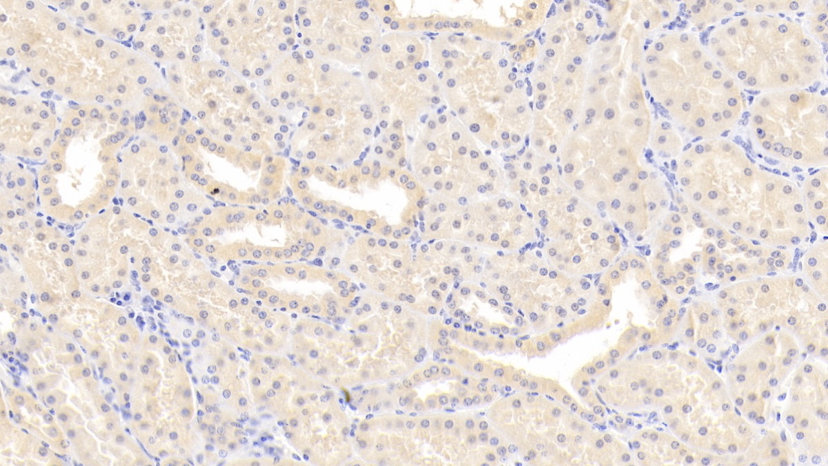 Polyclonal Antibody to Coagulation Factor II (F2)