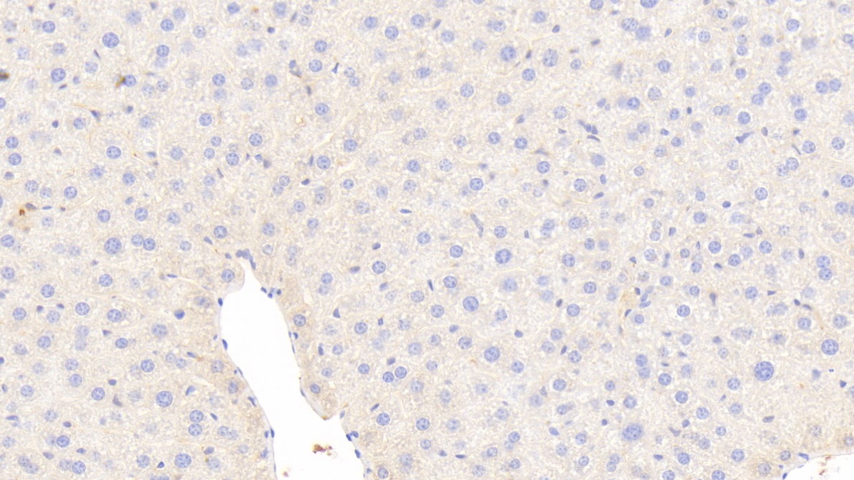 Polyclonal Antibody to Coagulation Factor II (F2)