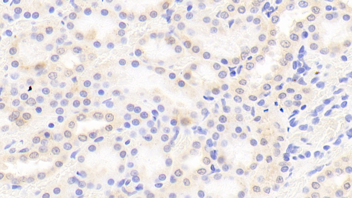 Polyclonal Antibody to Coagulation Factor II (F2)