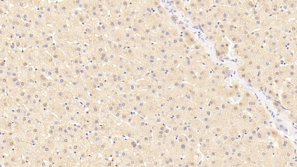 Polyclonal Antibody to C Reactive Protein (CRP)