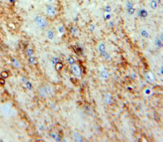 Polyclonal Antibody to Neuromedin S (NMS)