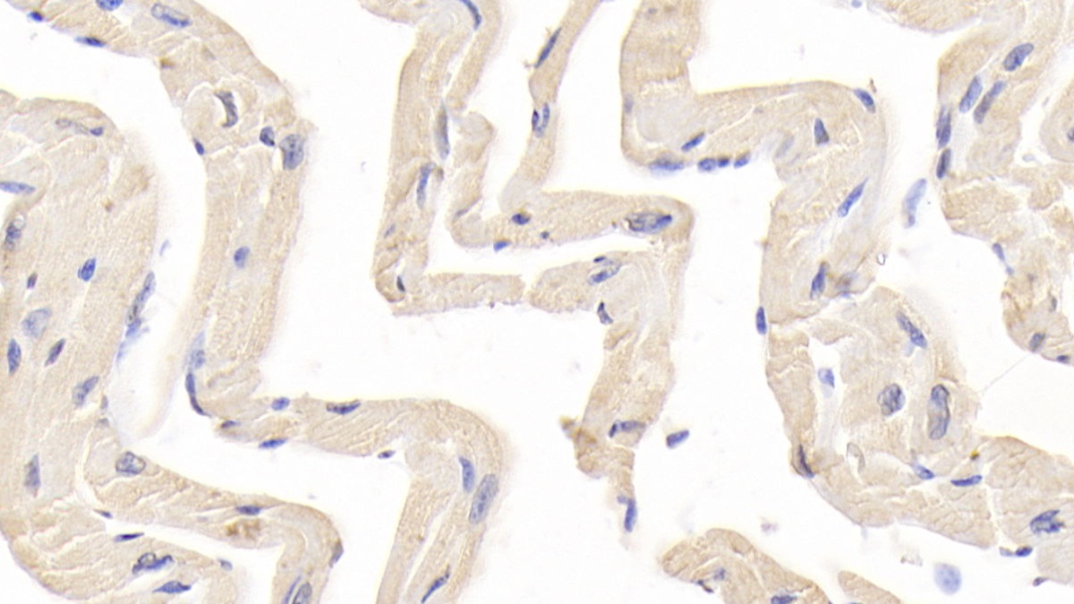 Polyclonal Antibody to Immunoglobulin G3 (IgG3)