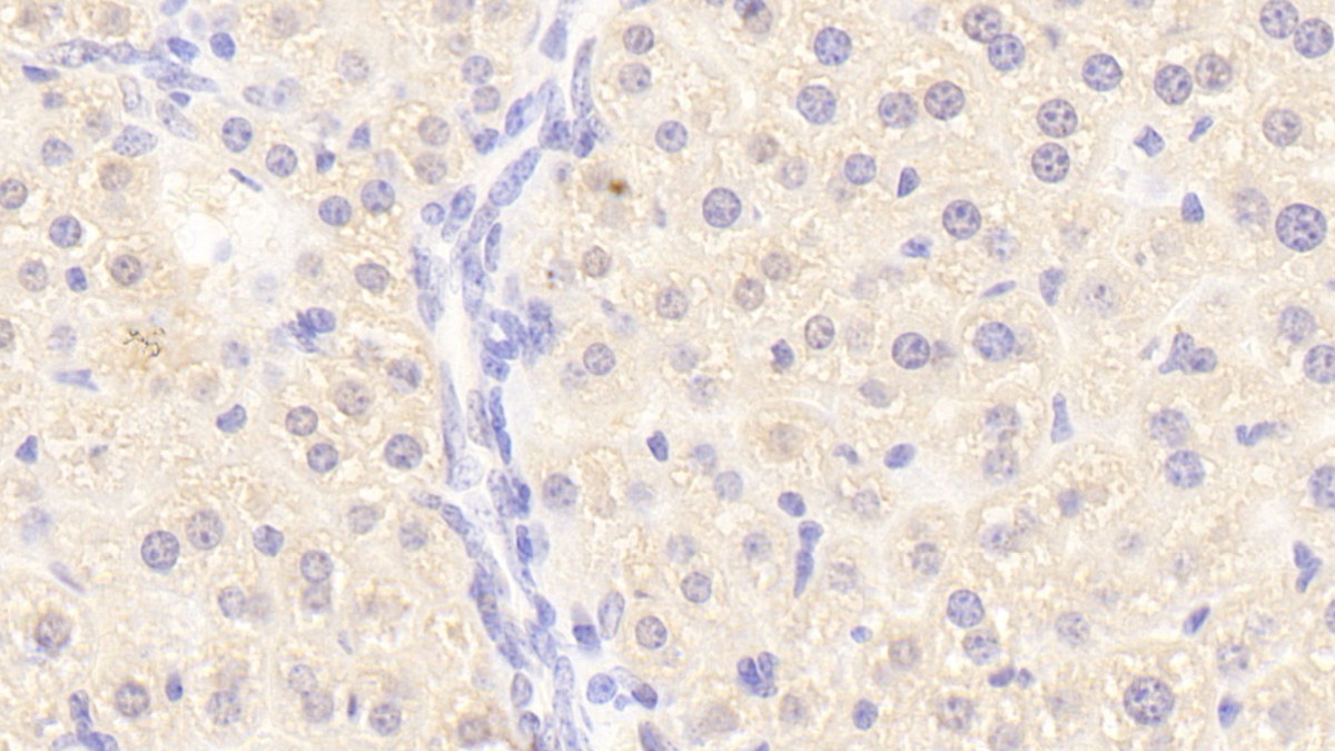 Polyclonal Antibody to Coagulation Factor X (F10)