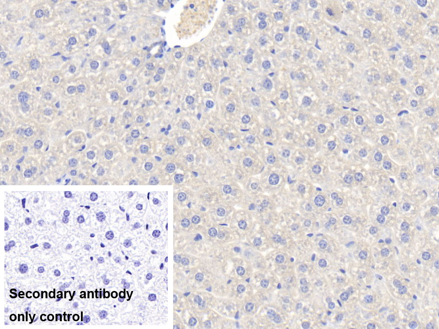 Polyclonal Antibody to Nitric Oxide Synthase 2, Inducible (NOS2)