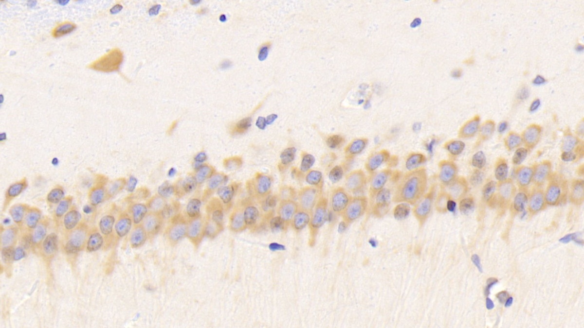 Polyclonal Antibody to Resistin (RETN)