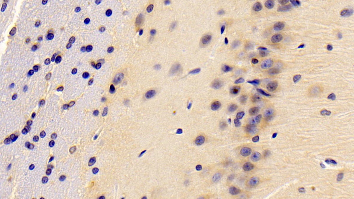 Polyclonal Antibody to Resistin (RETN)