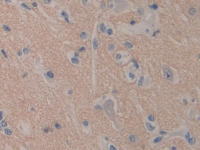 Polyclonal Antibody to Aminopeptidase A (ENPEP)