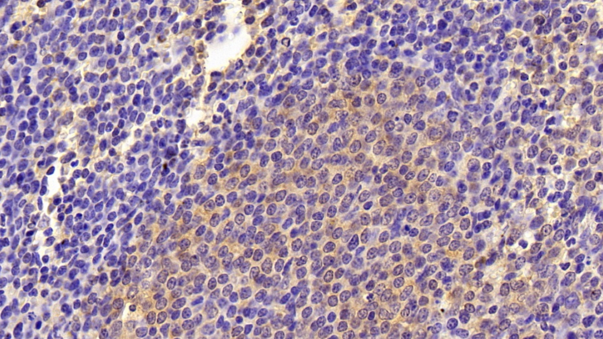 Polyclonal Antibody to Complement Component 3 (C3)