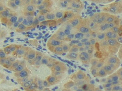 Polyclonal Antibody to Complement Component 2 (C2)