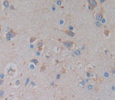 Polyclonal Antibody to Parathyroid Hormone (PTH)