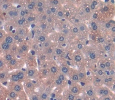 Polyclonal Antibody to Parathyroid Hormone (PTH)